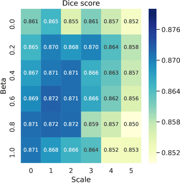 Figure 4 for Quantitative Impact of Label Noise on the Quality of Segmentation of Brain Tumors on MRI scans