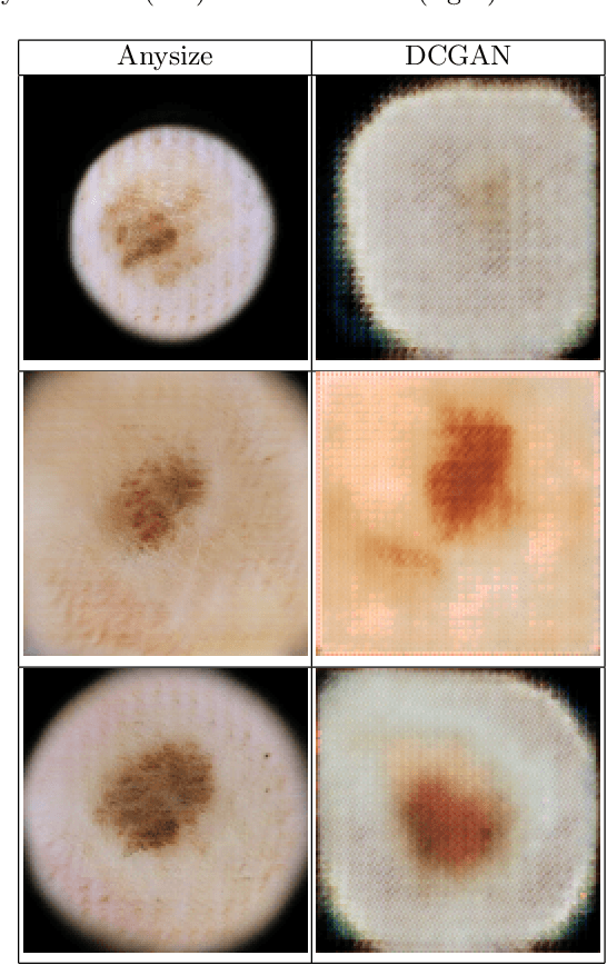 Figure 4 for Anysize GAN: A solution to the image-warping problem