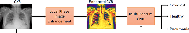 Figure 1 for Chest X-ray Image Phase Features for Improved Diagnosis of COVID-19 Using Convolutional Neural Network