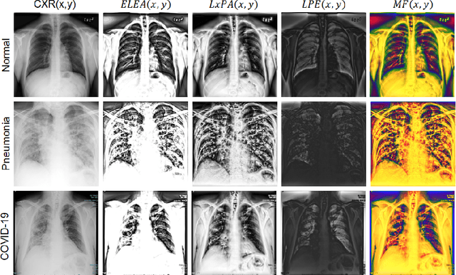 Figure 2 for Chest X-ray Image Phase Features for Improved Diagnosis of COVID-19 Using Convolutional Neural Network