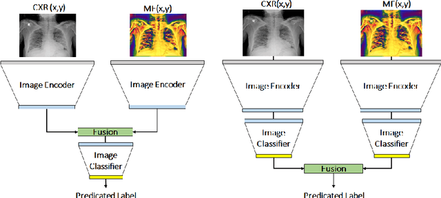 Figure 4 for Chest X-ray Image Phase Features for Improved Diagnosis of COVID-19 Using Convolutional Neural Network