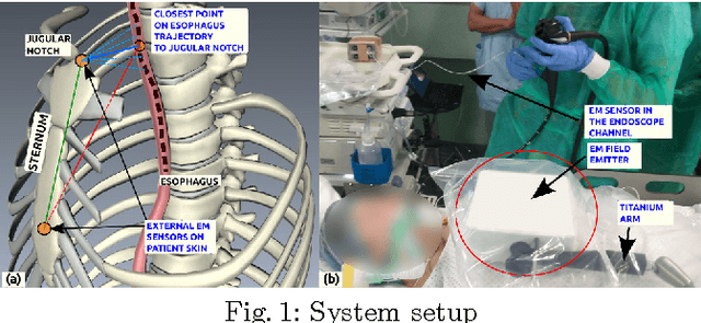 Figure 1 for Automatic View-Point Selection for Inter-Operative Endoscopic Surveillance