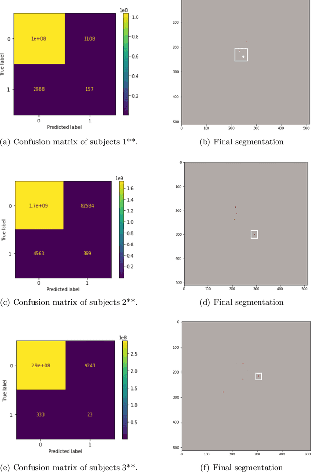 Figure 2 for MixMicrobleed: Multi-stage detection and segmentation of cerebral microbleeds