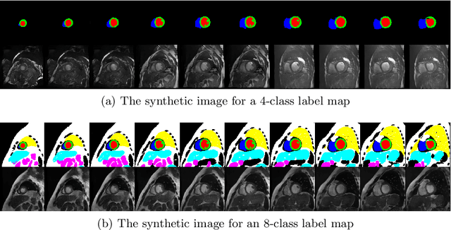 Figure 3 for XCAT-GAN for Synthesizing 3D Consistent Labeled Cardiac MR Images on Anatomically Variable XCAT Phantoms