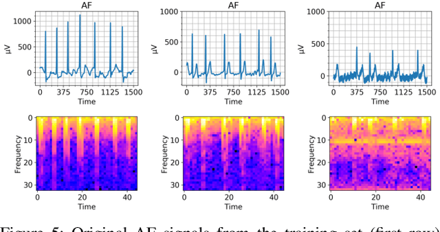 Figure 4 for The Effect of Data Augmentation on Classification of Atrial Fibrillation in Short Single-Lead ECG Signals Using Deep Neural Networks