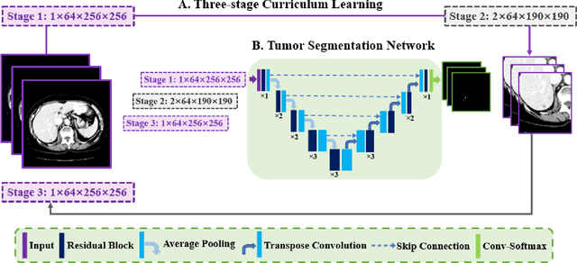 Figure 1 for A New Three-stage Curriculum Learning Approach to Deep Network Based Liver Tumor Segmentation