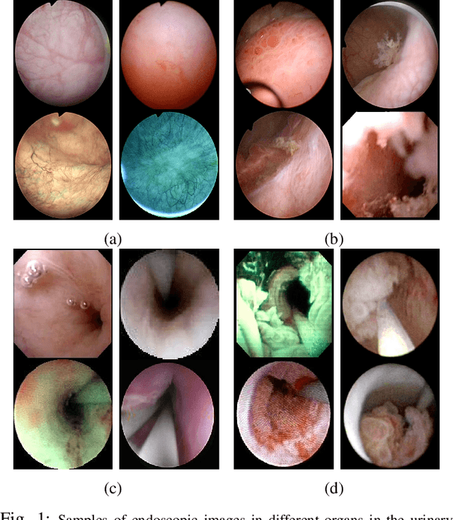 Figure 1 for A transfer-learning approach for lesion detection in endoscopic images from the urinary tract