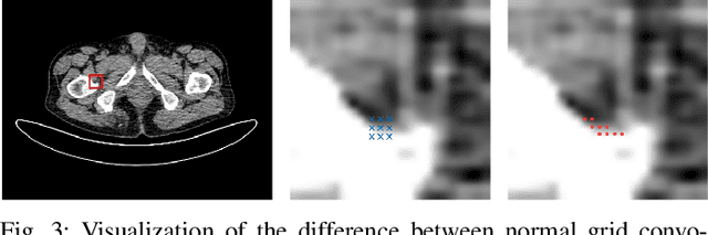 Figure 3 for Total-Body Low-Dose CT Image Denoising using Prior Knowledge Transfer Technique with Contrastive Regularization Mechanism