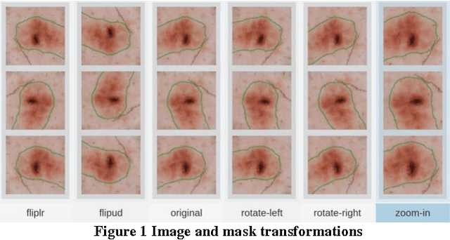 Figure 1 for ISIC 2017 - Skin Lesion Analysis Towards Melanoma Detection