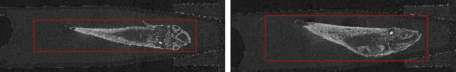 Figure 1 for Self Supervised Learning for Object Localisation in 3D Tomographic Images