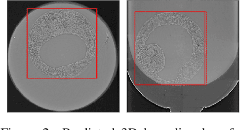 Figure 2 for Self Supervised Learning for Object Localisation in 3D Tomographic Images