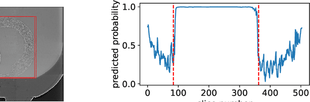 Figure 3 for Self Supervised Learning for Object Localisation in 3D Tomographic Images