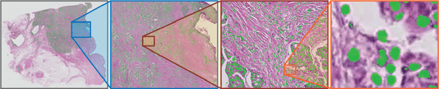 Figure 1 for FastPathology: An open-source platform for deep learning-based research and decision support in digital pathology