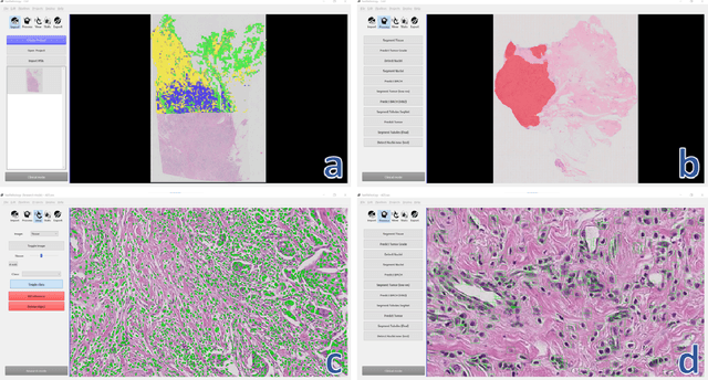 Figure 4 for FastPathology: An open-source platform for deep learning-based research and decision support in digital pathology