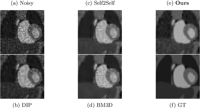 Figure 4 for Poisson2Sparse: Self-Supervised Poisson Denoising From a Single Image