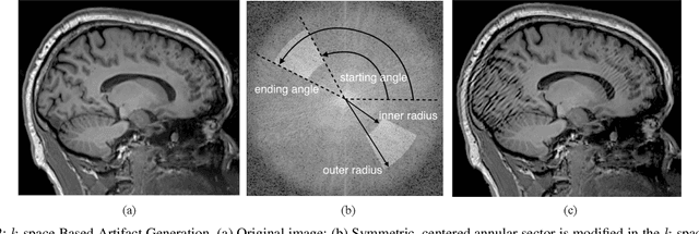 Figure 2 for Localized Motion Artifact Reduction on Brain MRI Using Deep Learning with Effective Data Augmentation Techniques