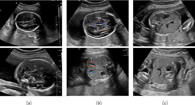 Figure 3 for Automatic quality assessment for 2D fetal sonographic standard plane based on multi-task learning