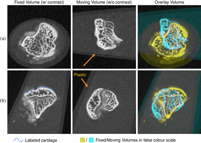 Figure 3 for D-Net: Siamese based Network with Mutual Attention for Volume Alignment