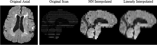 Figure 1 for Fast Learning-based Registration of Sparse Clinical Images