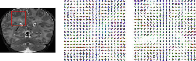 Figure 3 for A machine learning-based method for estimating the number and orientations of major fascicles in diffusion-weighted magnetic resonance imaging