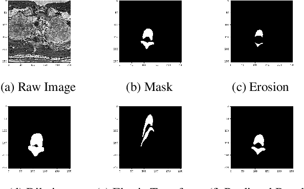 Figure 3 for RRA-U-Net: a Residual Encoder to Attention Decoder by Residual Connections Framework for Spine Segmentation under Noisy Labels