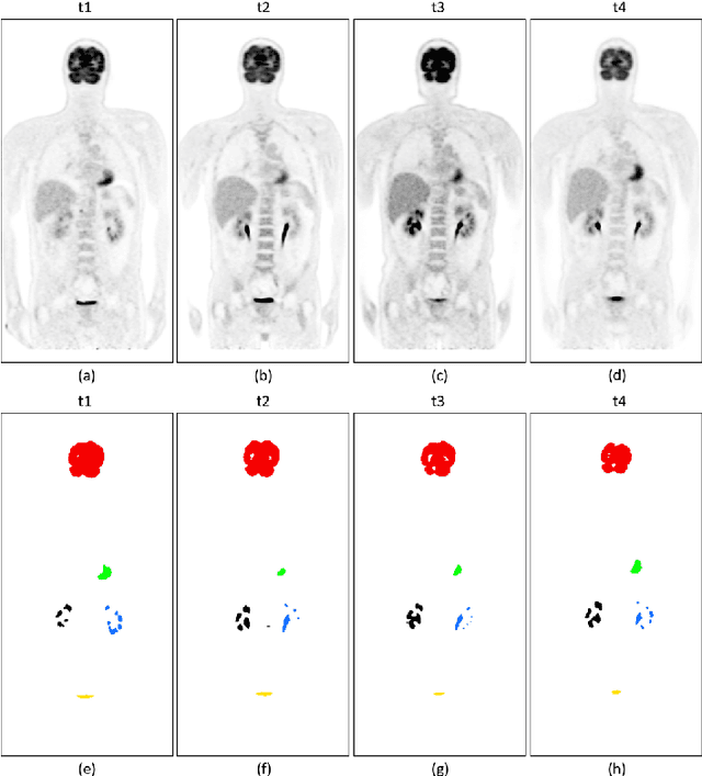 Figure 1 for Spatio-Temporal Dual-Stream Neural Network for Sequential Whole-Body PET Segmentation