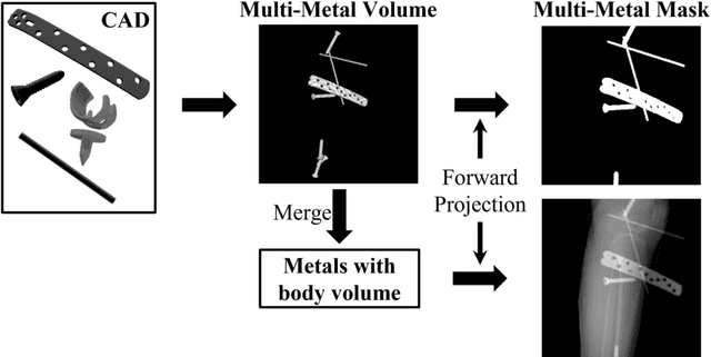 Figure 1 for Simulation-Driven Training of Vision Transformers Enabling Metal Segmentation in X-Ray Images