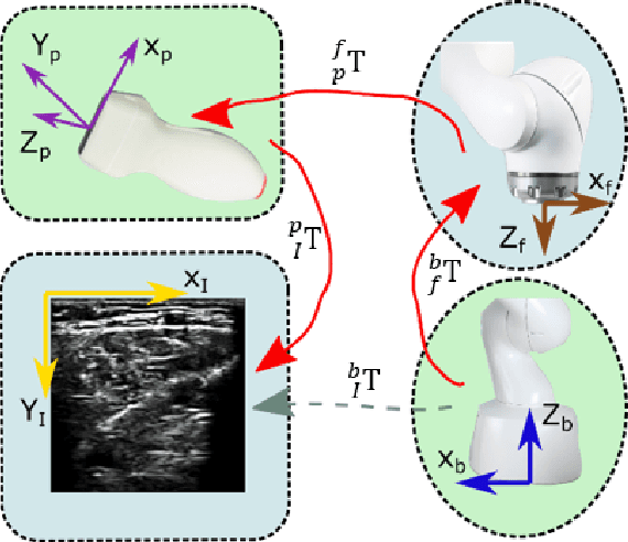 Figure 4 for Autonomous Robotic Screening of Tubular Structures based only on Real-Time Ultrasound Imaging Feedback