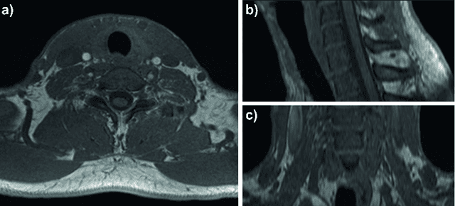 Figure 1 for Tracked 3D Ultrasound and Deep Neural Network-based Thyroid Segmentation reduce Interobserver Variability in Thyroid Volumetry