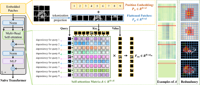 Figure 1 for The Lighter The Better: Rethinking Transformers in Medical Image Segmentation Through Adaptive Pruning