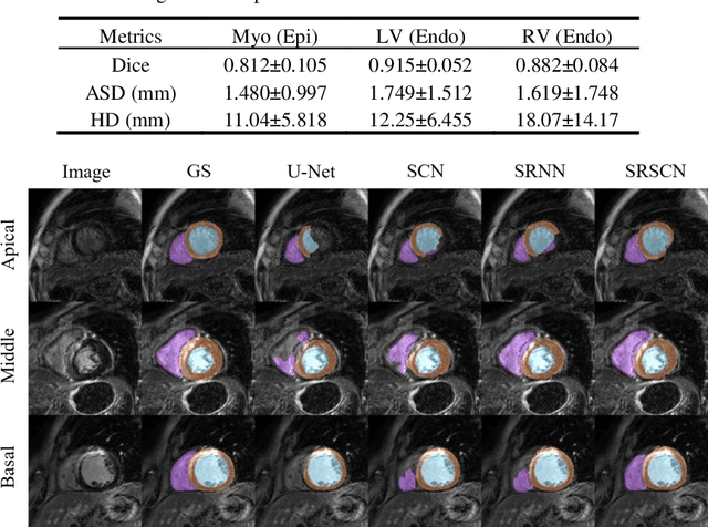 Figure 2 for Cardiac Segmentation from LGE MRI Using Deep Neural Network Incorporating Shape and Spatial Priors