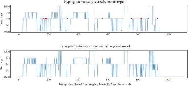 Figure 4 for Adaptive Spike-Like Representation of EEG Signals for Sleep Stages Scoring