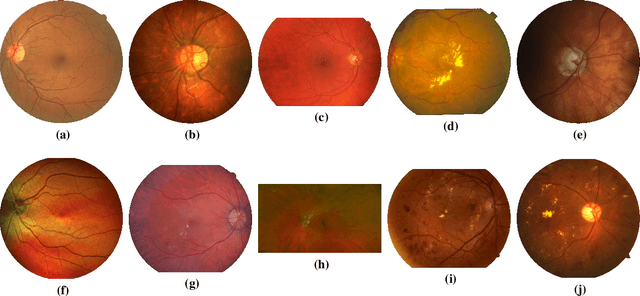 Figure 1 for The Little W-Net That Could: State-of-the-Art Retinal Vessel Segmentation with Minimalistic Models