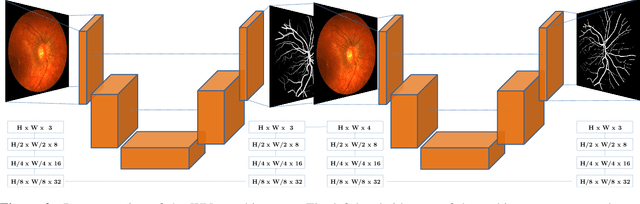 Figure 3 for The Little W-Net That Could: State-of-the-Art Retinal Vessel Segmentation with Minimalistic Models