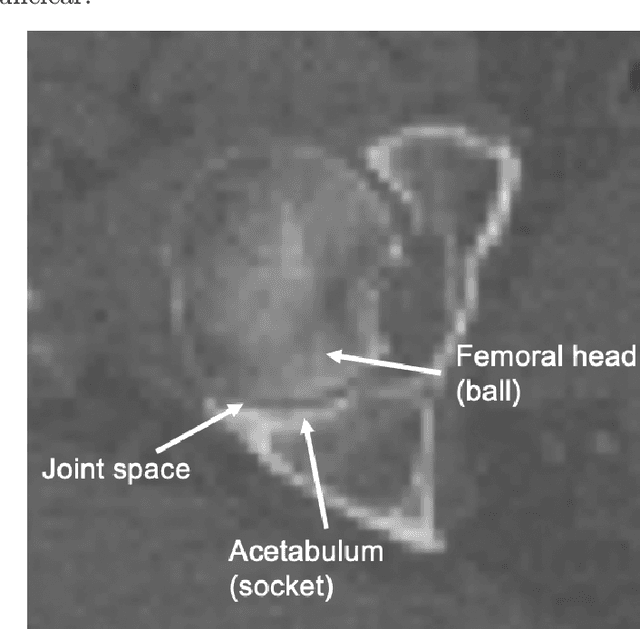 Figure 1 for Fast and Robust Femur Segmentation from Computed Tomography Images for Patient-Specific Hip Fracture Risk Screening