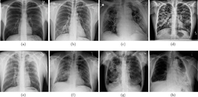 Figure 1 for MobileCaps: A Lightweight Model for Screening and Severity Analysis of COVID-19 Chest X-Ray Images