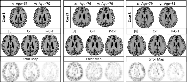 Figure 4 for Degenerative Adversarial NeuroImage Nets: Generating Images that Mimic Disease Progression