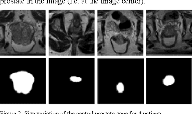 Figure 2 for A new smart-cropping pipeline for prostate segmentation using deep learning networks