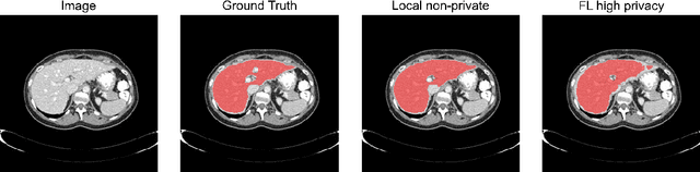 Figure 4 for Differentially private federated deep learning for multi-site medical image segmentation