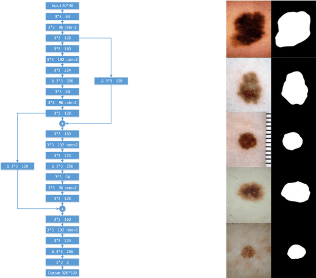 Figure 2 for ISIC 2018-A Method for Lesion Segmentation