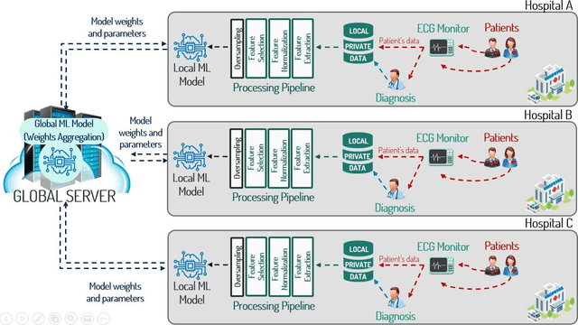 Figure 1 for Application of federated learning techniques for arrhythmia classification using 12-lead ECG signals