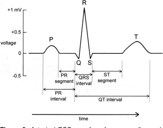 Figure 3 for Application of federated learning techniques for arrhythmia classification using 12-lead ECG signals