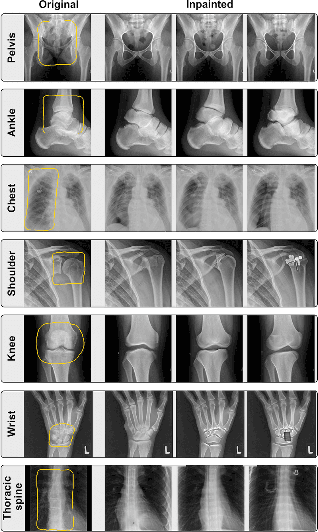 Figure 3 for What Does DALL-E 2 Know About Radiology?