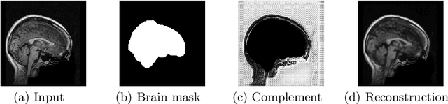 Figure 4 for CompNet: Complementary Segmentation Network for Brain MRI Extraction
