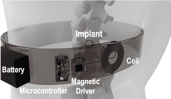 Figure 1 for MagNI: A Magnetoelectrically Powered and Controlled Wireless Neurostimulating Implant
