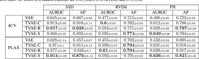 Figure 4 for Interpretable Anomaly Detection in Echocardiograms with Dynamic Variational Trajectory Models