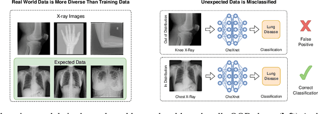 Figure 1 for A knee cannot have lung disease: out-of-distribution detection with in-distribution voting using the medical example of chest X-ray classification