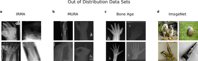 Figure 3 for A knee cannot have lung disease: out-of-distribution detection with in-distribution voting using the medical example of chest X-ray classification