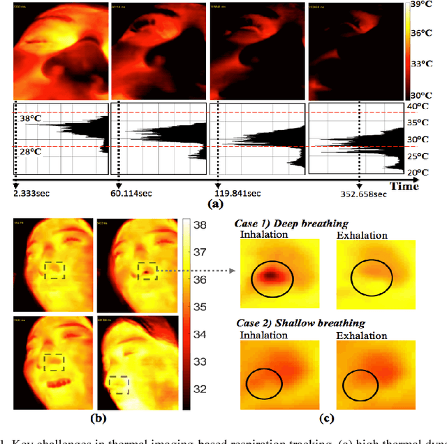 Figure 1 for Robust tracking of respiratory rate in high-dynamic range scenes using mobile thermal imaging