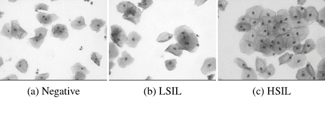 Figure 1 for A New Cervical Cytology Dataset for Nucleus Detection and Image Classification  and Methods for Cervical Nucleus Detection